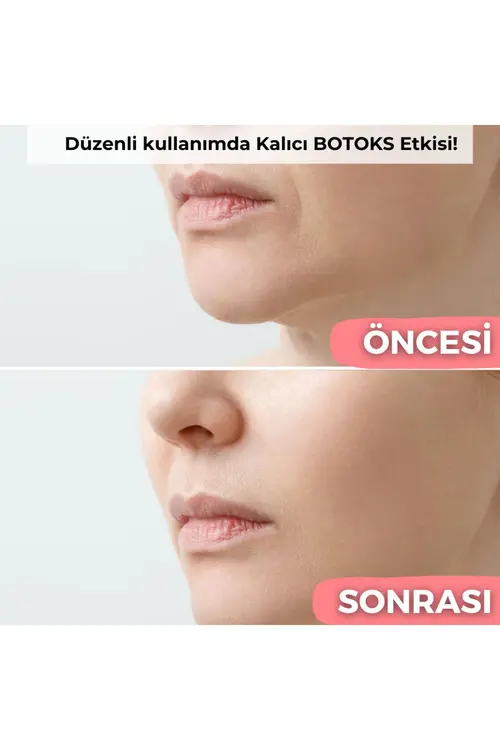 Peluş Dünyam Şeffaflaşan Kore Yüz Maske Yaşlanma Karşıtı Parlaklık Nemlendirme Gözenek Sıkılaştırıcı